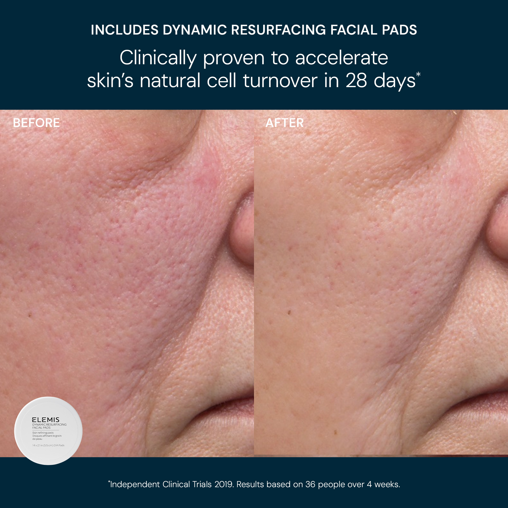 Тріо для сяйва шкіри ELEMIS Glow Bright Resurfacing Trio Kit